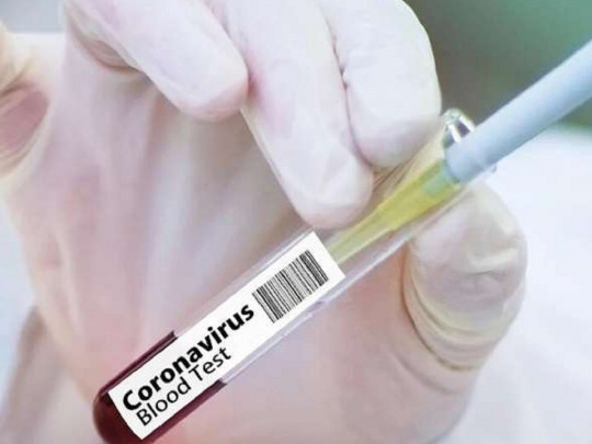 Проверка на коронавирус: стало известно, во сколько обойдется ПЦР-тестирование