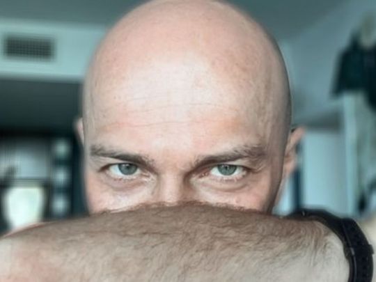 Бандит, Джим Керрі та&nbsp;Зідан в&nbsp;одній особі: поголений Яма шокував фанатів