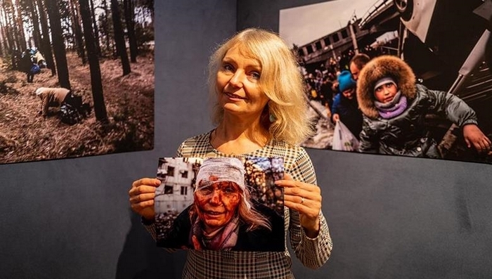«Спочатку я була шокована»: вчителька після важкого поранення очей зустрілась з автором фото, яке зробило її відомою на весь світ