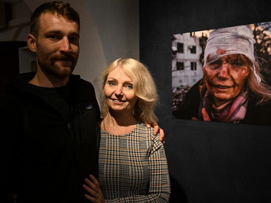 «Спочатку я була шокована»: вчителька після важкого поранення очей зустрілась з автором фото, яке зробило її відомою на весь світ